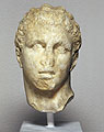 Athlete's head